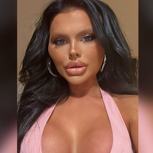 Fabi 1